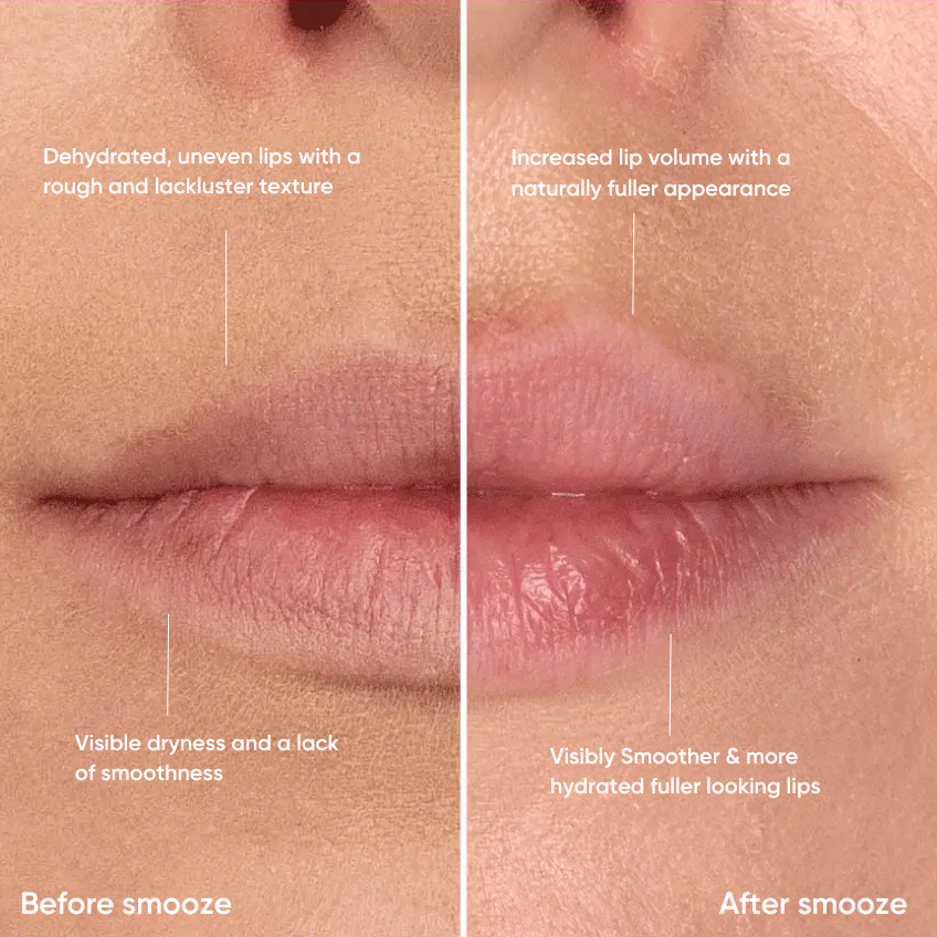 Gradual Lip Plumper