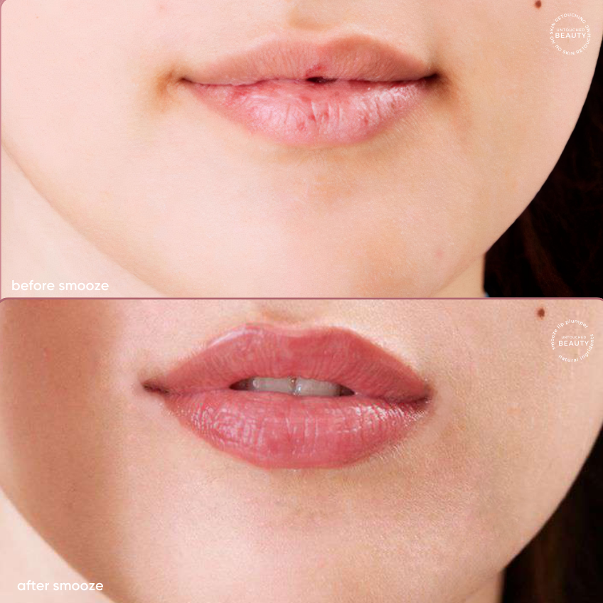 beforeandafterlips_4.png